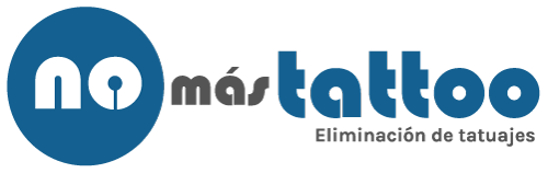 Eliminación de tatuajes en Las Palmas