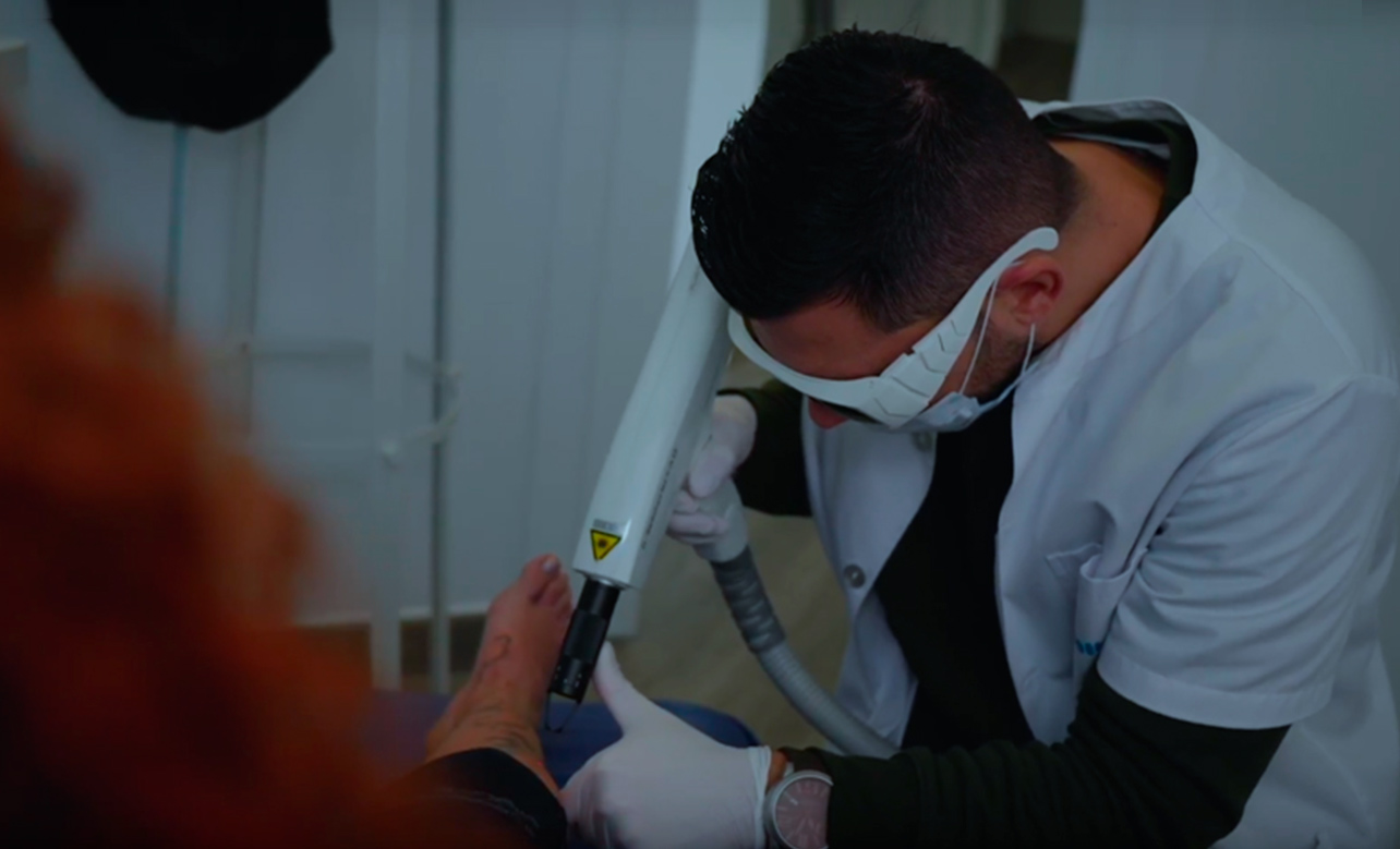 eliminación de tatuajes en Las Palmas